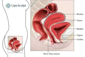 Treatment For A Leaky Bladder 2 How EM Chair treatment Dunstable can help Leaky bladder issues. Read more now!
