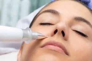 Best Actinic Keratoses Removal 3 Actinic keratoses Dunstable solutions - book in today!